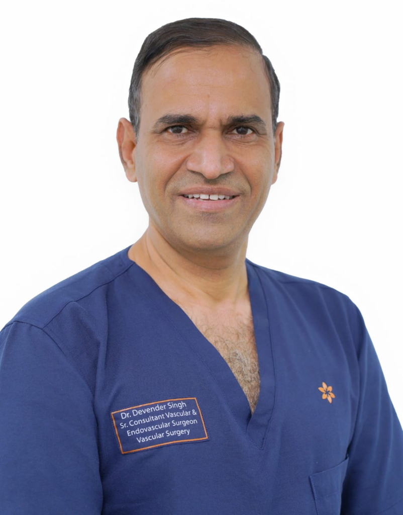 Dr. Devender Singh Vascular Surgeon